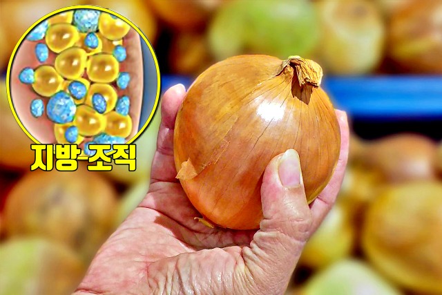 만성 염증 치료에 좋은 음식, 양파 효능