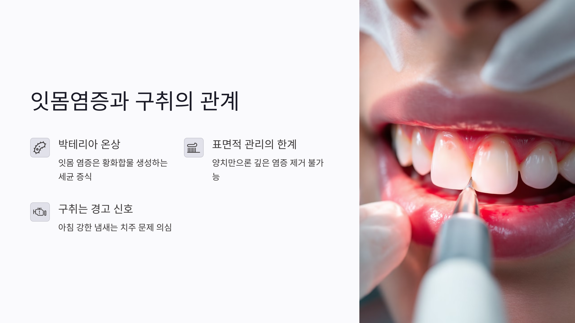 입냄새 원인 중 하나, 잇몸염증과 구취의 관계