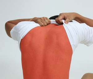 뜨거운 물에 데었을때 응급처치