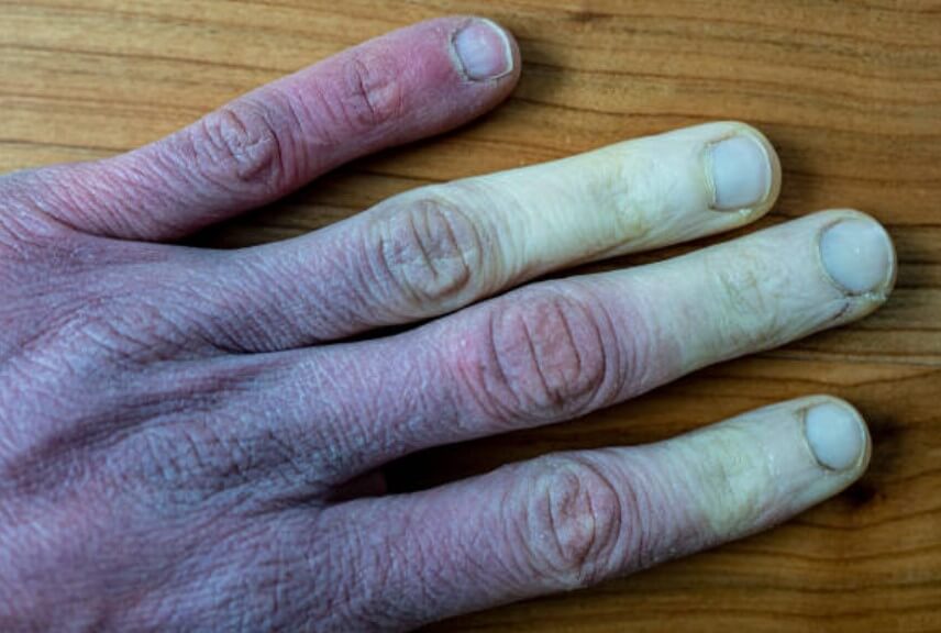 동상예방법-방한복