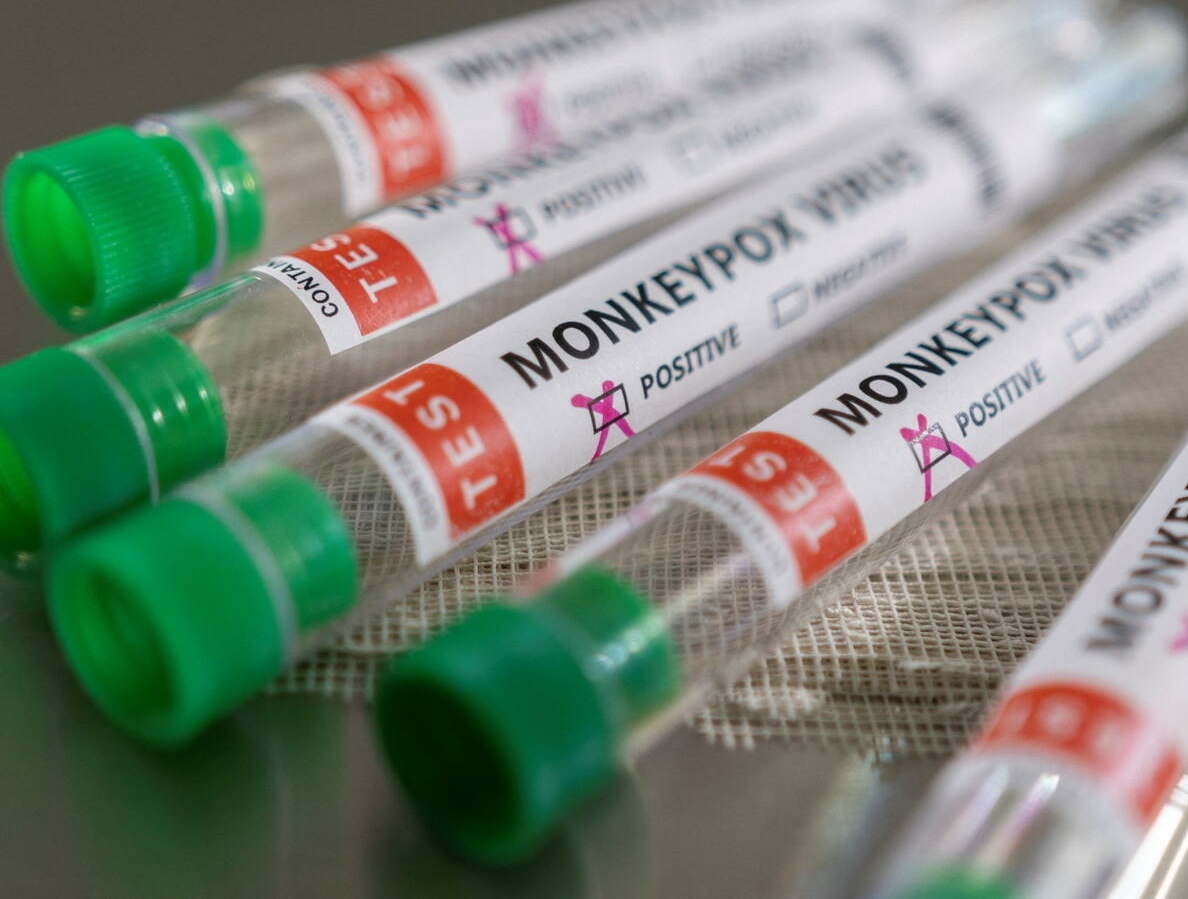 몽키폭스 바이러스