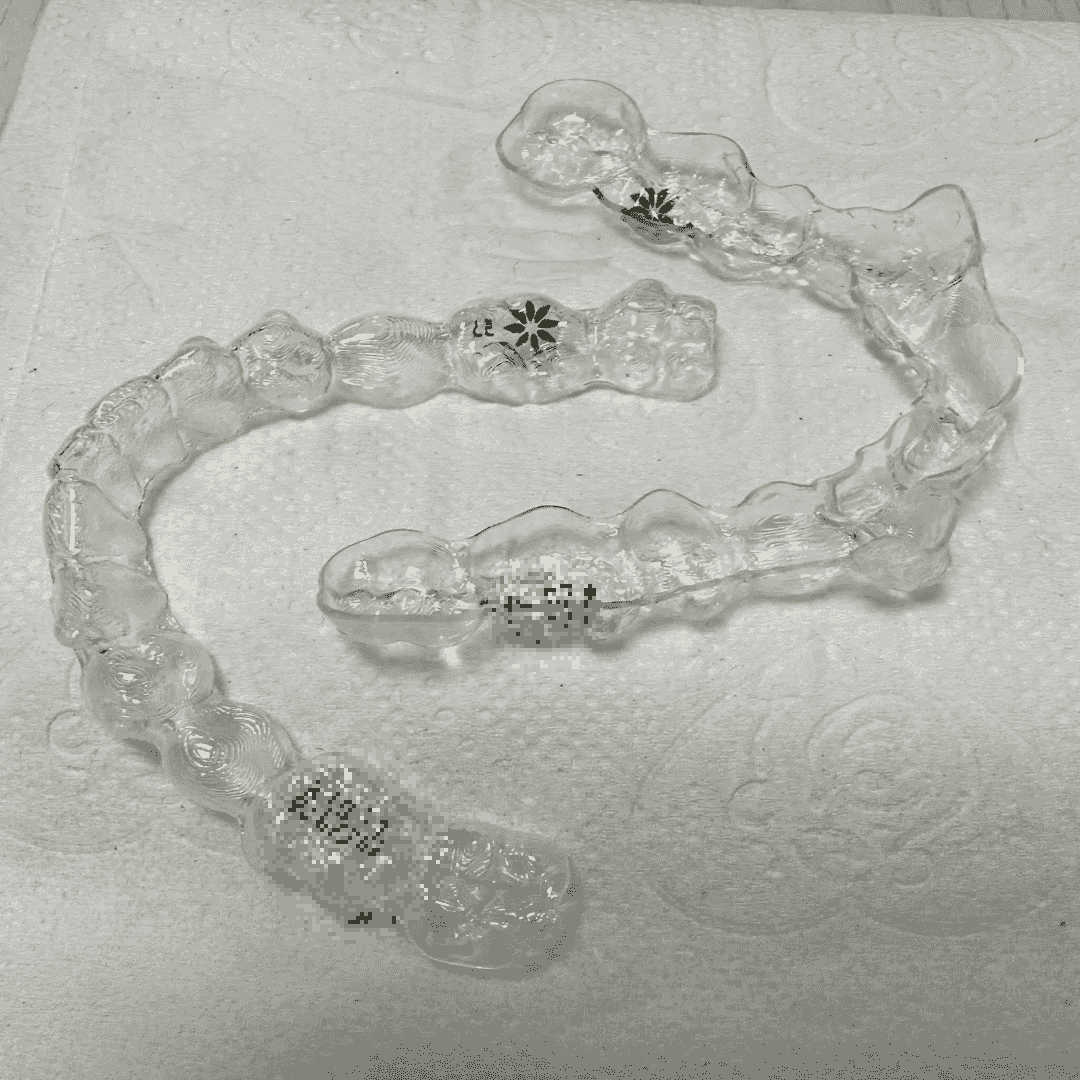 얼라이너의-모습