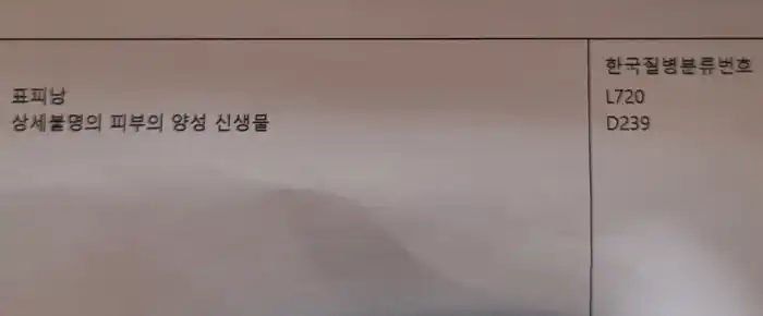 표피낭종-진단
