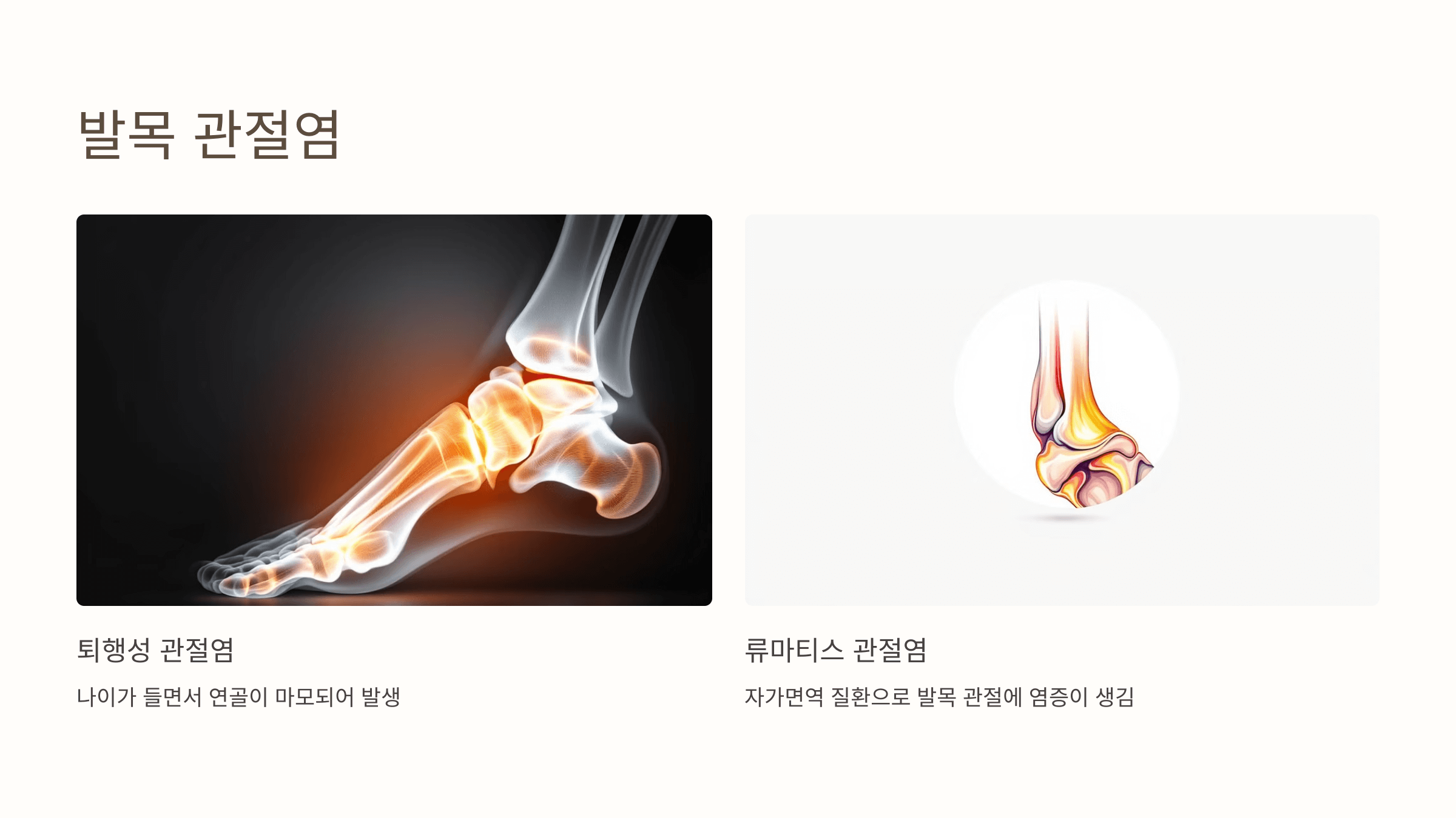 발목 통증과 관련된 사진입니다.