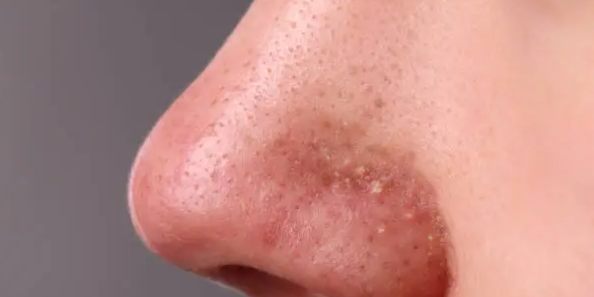 코 모공까지 보이는 확대 사진