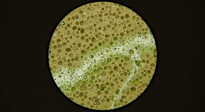 다공성(미세한 구멍이 많은) 재질