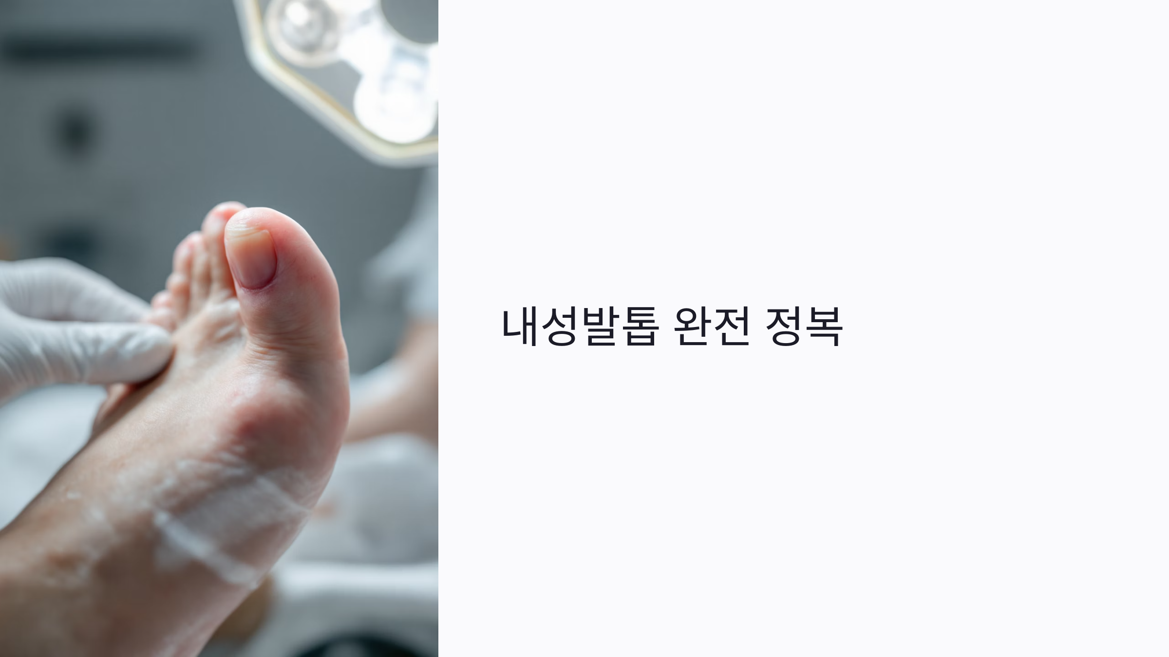 내성발톱, 언제 병원 가야 할까? 초기 증상부터 예방법까지