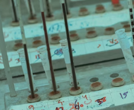 폐경기 검사 방법