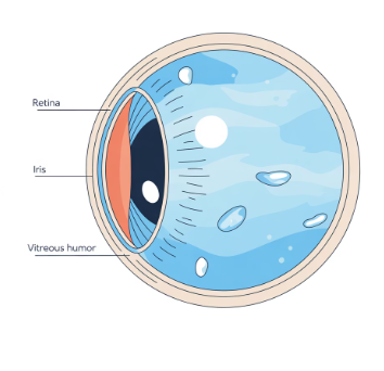비문증 치료방법
