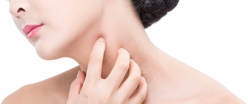 대상포진 예방과 치료