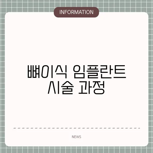 뼈이식 임플란트 시술 과정