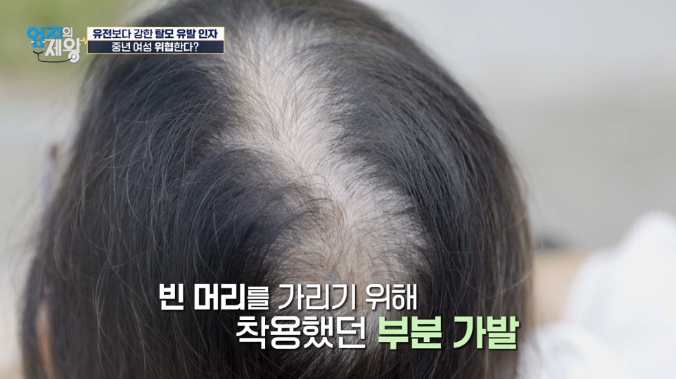 부분가발을 착용 한 도전자