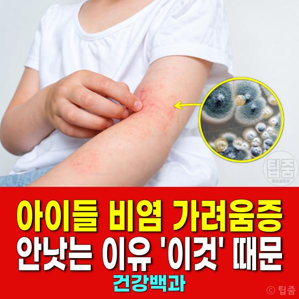 알레르기 비염 가려움증 아이
