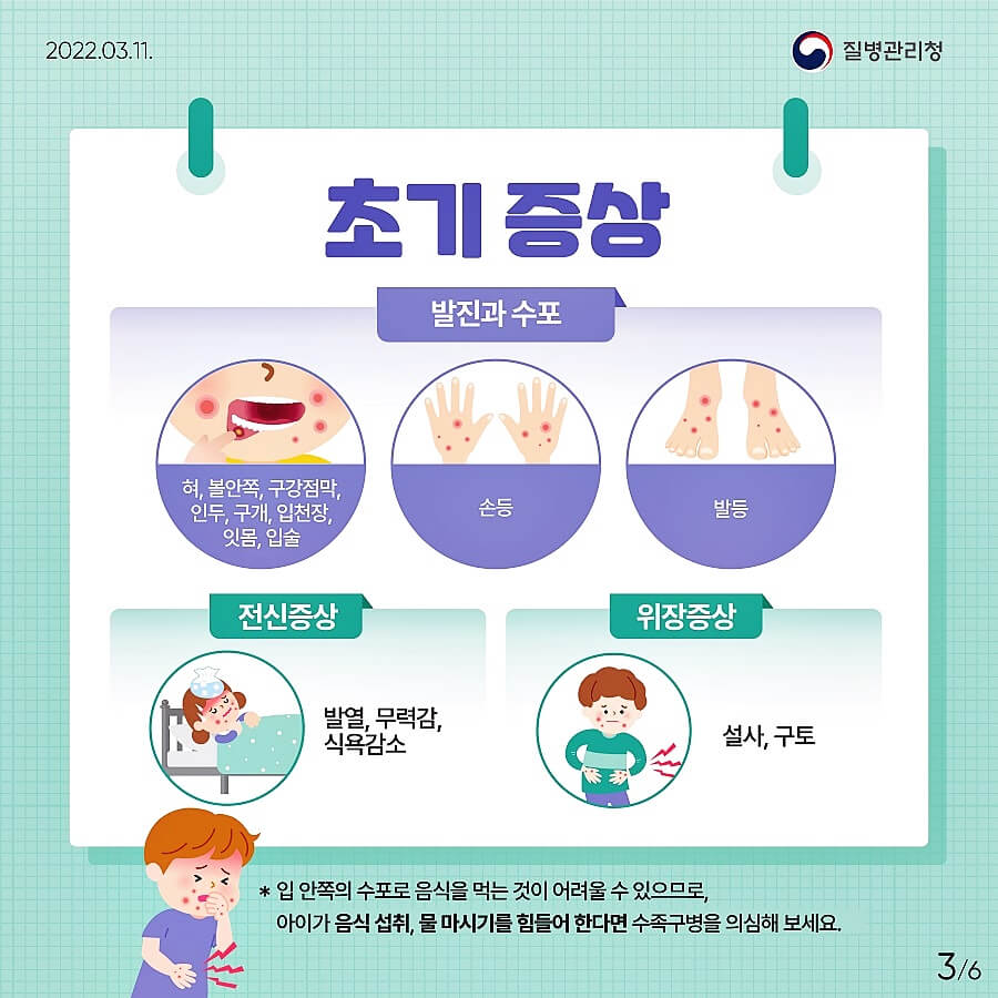 수족구-증상-설명