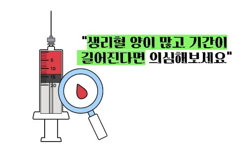 자궁내막증 초기증상