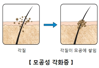 오돌토돌