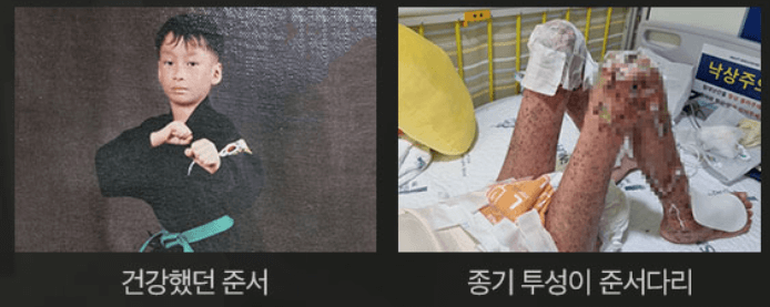 준서의 종기와 피고름