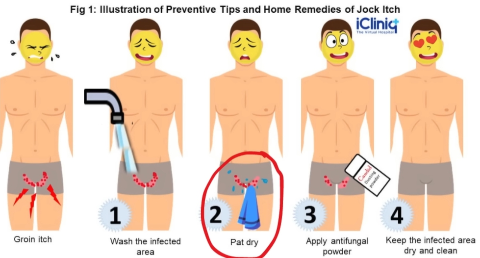 사타구니 가려움증