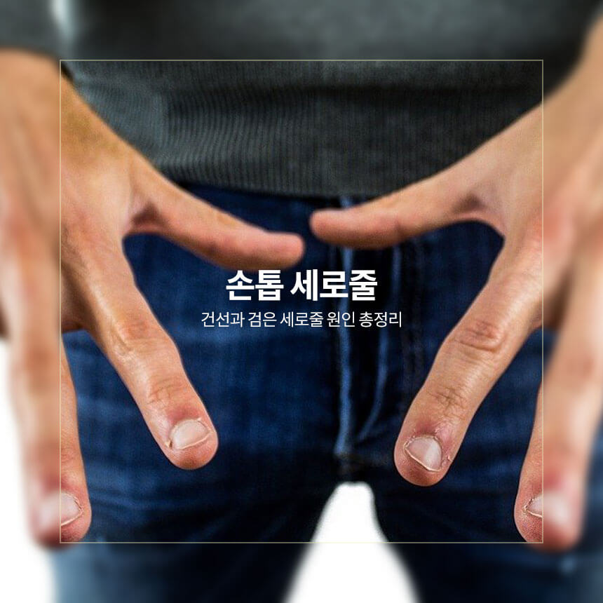 손톱 세로줄, 건선과 검은 세로줄 원인