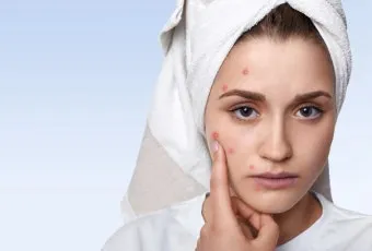 생리 전 뾰루지 폭발 원인과 해결법 7가지 생리 전후 뾰루지 발생 이유 완벽 분석_15