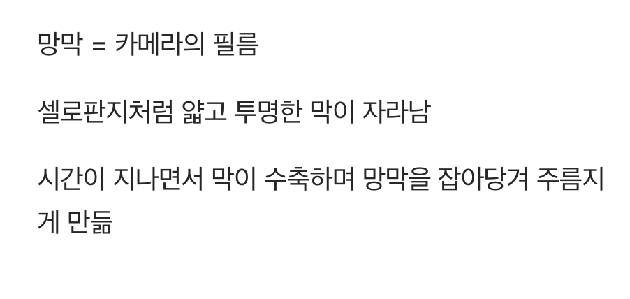 내 눈 속 필름에 낀 투명한 주름