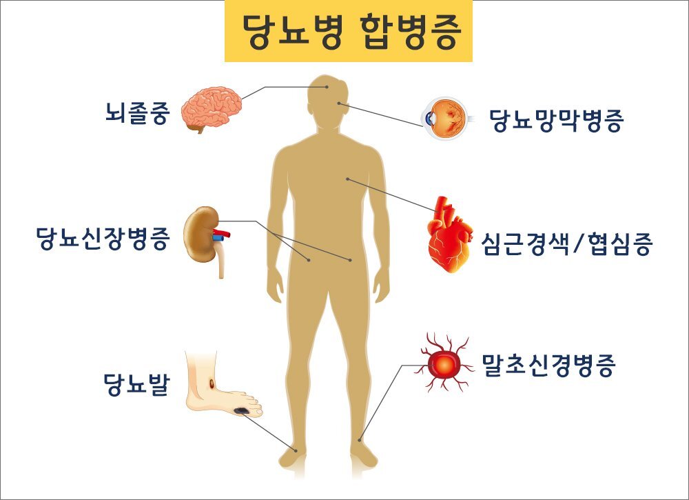 당뇨병 합병증
