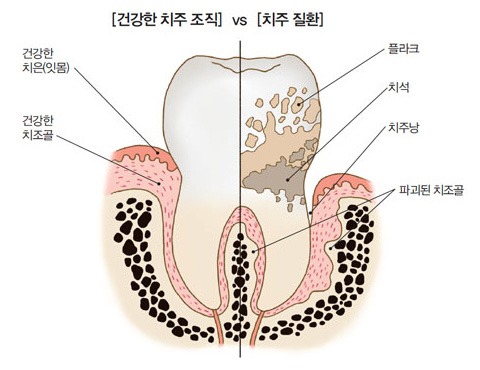 입속을 지키면 밤도 지킨다-설명