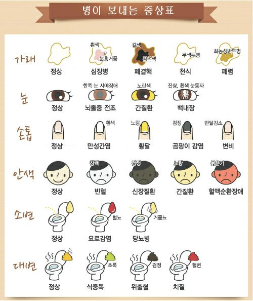 가래 색깔별 증상 생기는 원인 없애는 방법 노란색&amp;#44; 초록색(녹색)&amp;#44; 흰색 원인 끈적한 가래&amp;#44; 피 섞인 가래