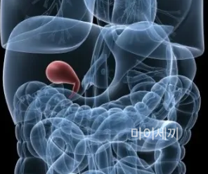 담낭