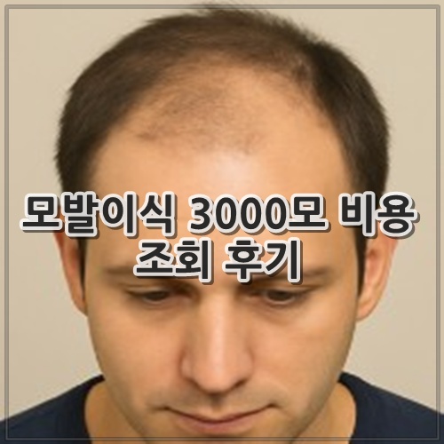 모발이식 3000모 비용 조회 후기
