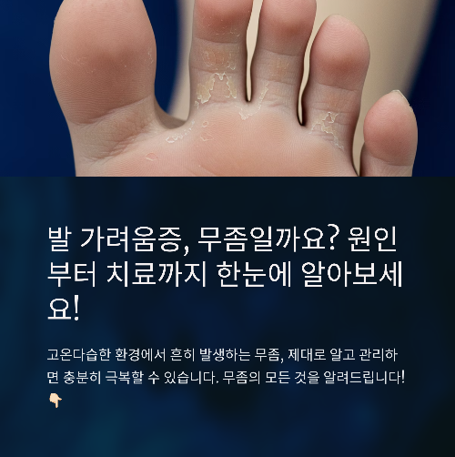 무좀 원인, 증상, 치료 및 예방법