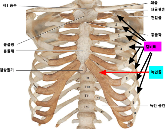 갈비뼈금간-사진1