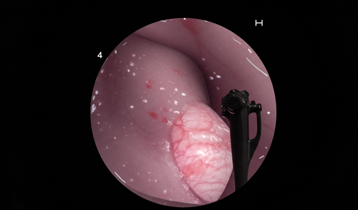 국민건강보험 위내시경 정책 변화, 꼭 알아두어야 할 검진 주기 개정안