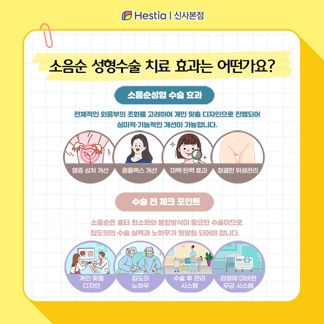 소음순 성형수술의 치료 효과는?