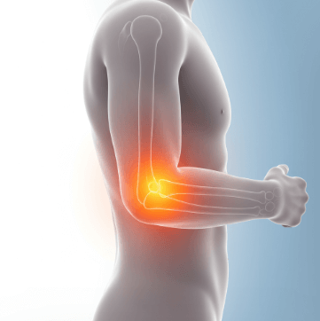 팔꿈치 통증 원인과 치료법1