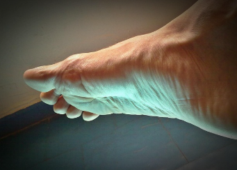 발톱이 검게 변하는 이유 7가지와 해결 방법 9