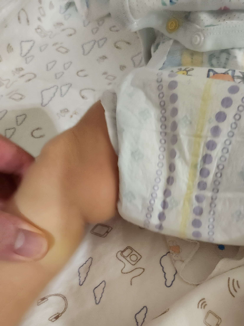 펨퍼스-베이비드라이-허벅지