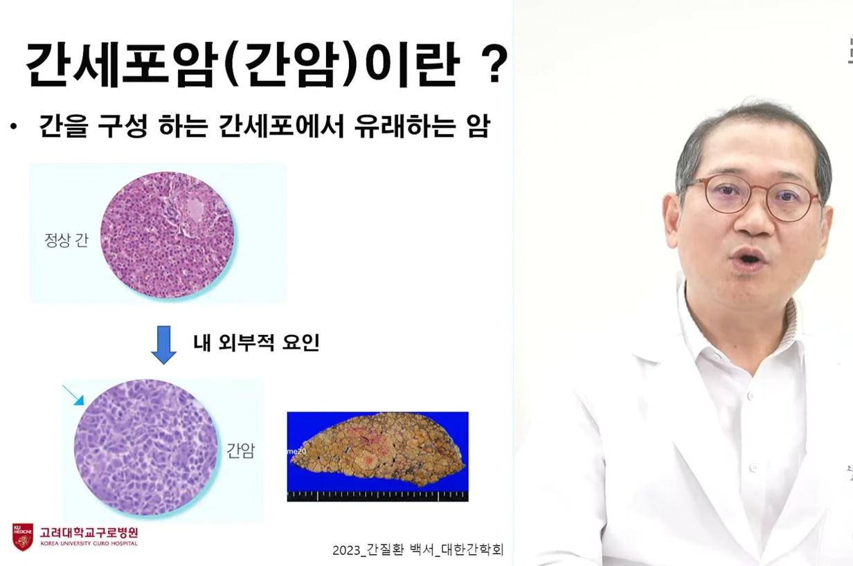 EBS명의-지방간염-김지훈-교수