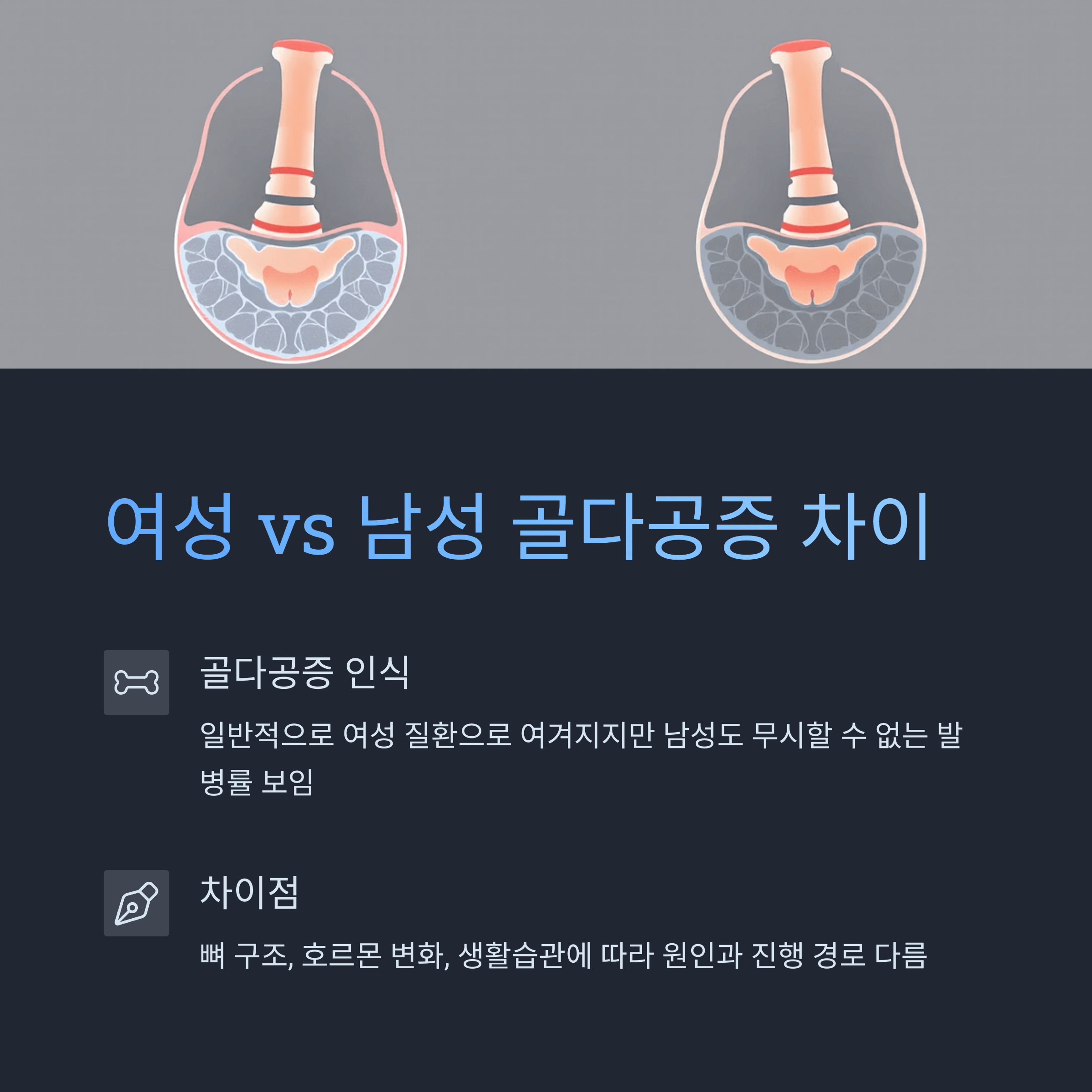 여성 vs 남성 골다공증 차이