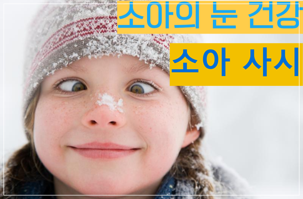 소아 사시와 약시