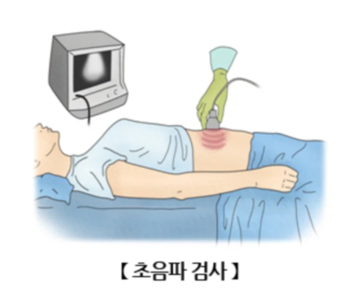 복부초음파