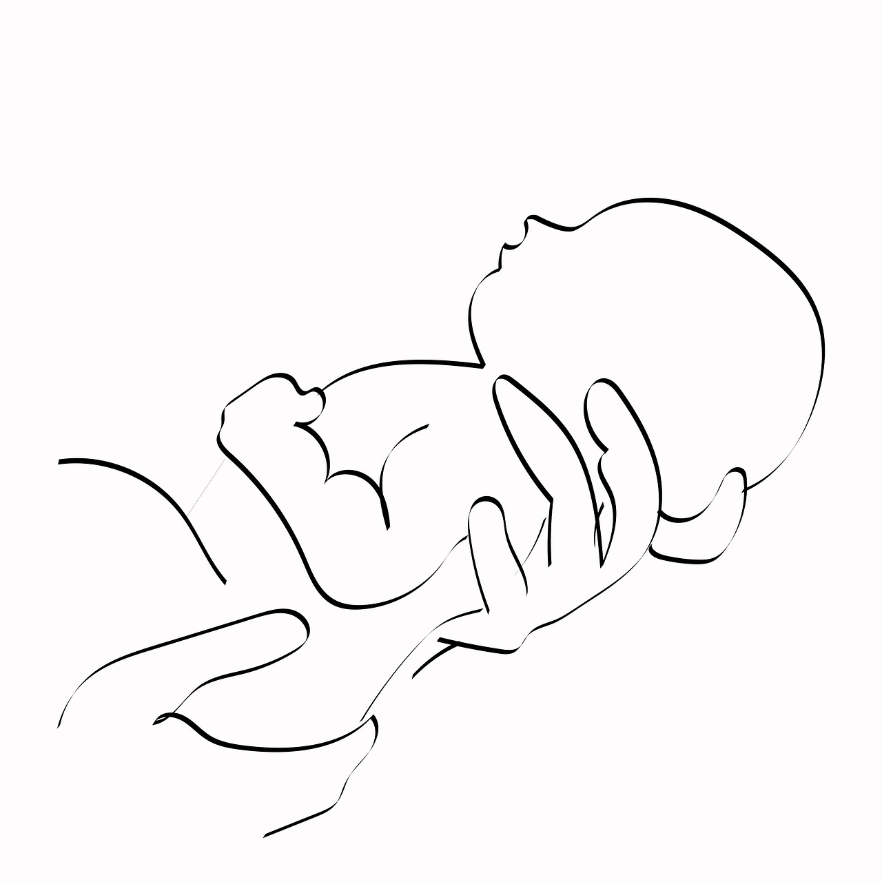 선천성 대사이상 증상 관련 사진