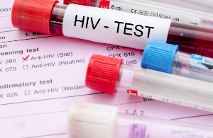 HIV의 초기 증상