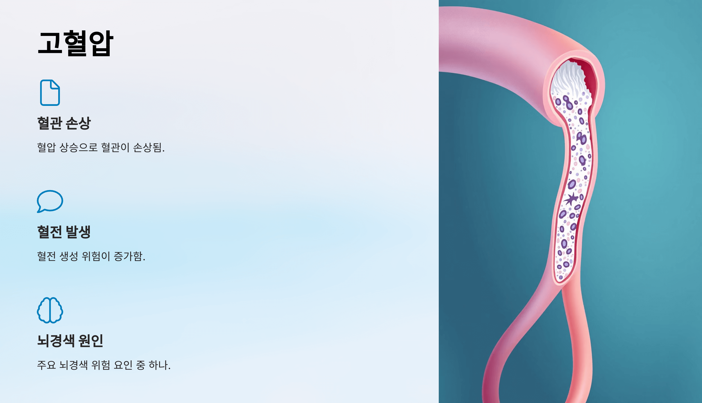 뇌경색과 관련된 사진입니다.