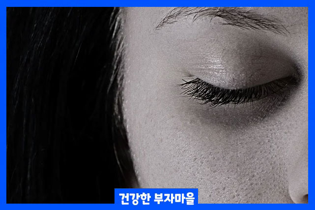 안면신경의 염증 이나 외상으로 인해 한쪽 얼굴이 일시적 마비되면서 눈꺼풀 떨림현상이 나타날 수 있습니다.