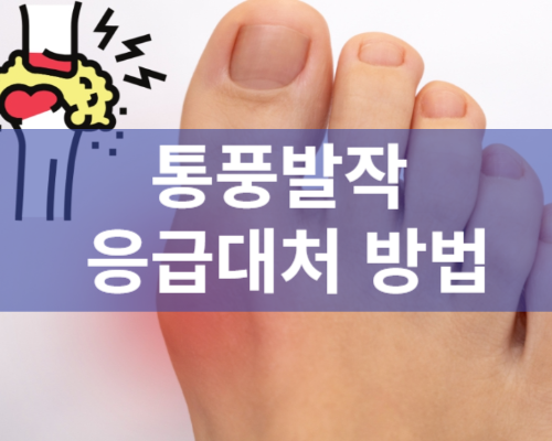 통풍발작 응급 대처 치료 방법 - 소염진통제 복용