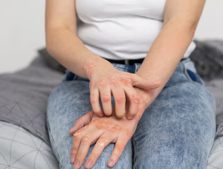 발이 붓는 이유 25