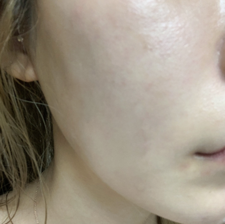 아이올리지오 후기