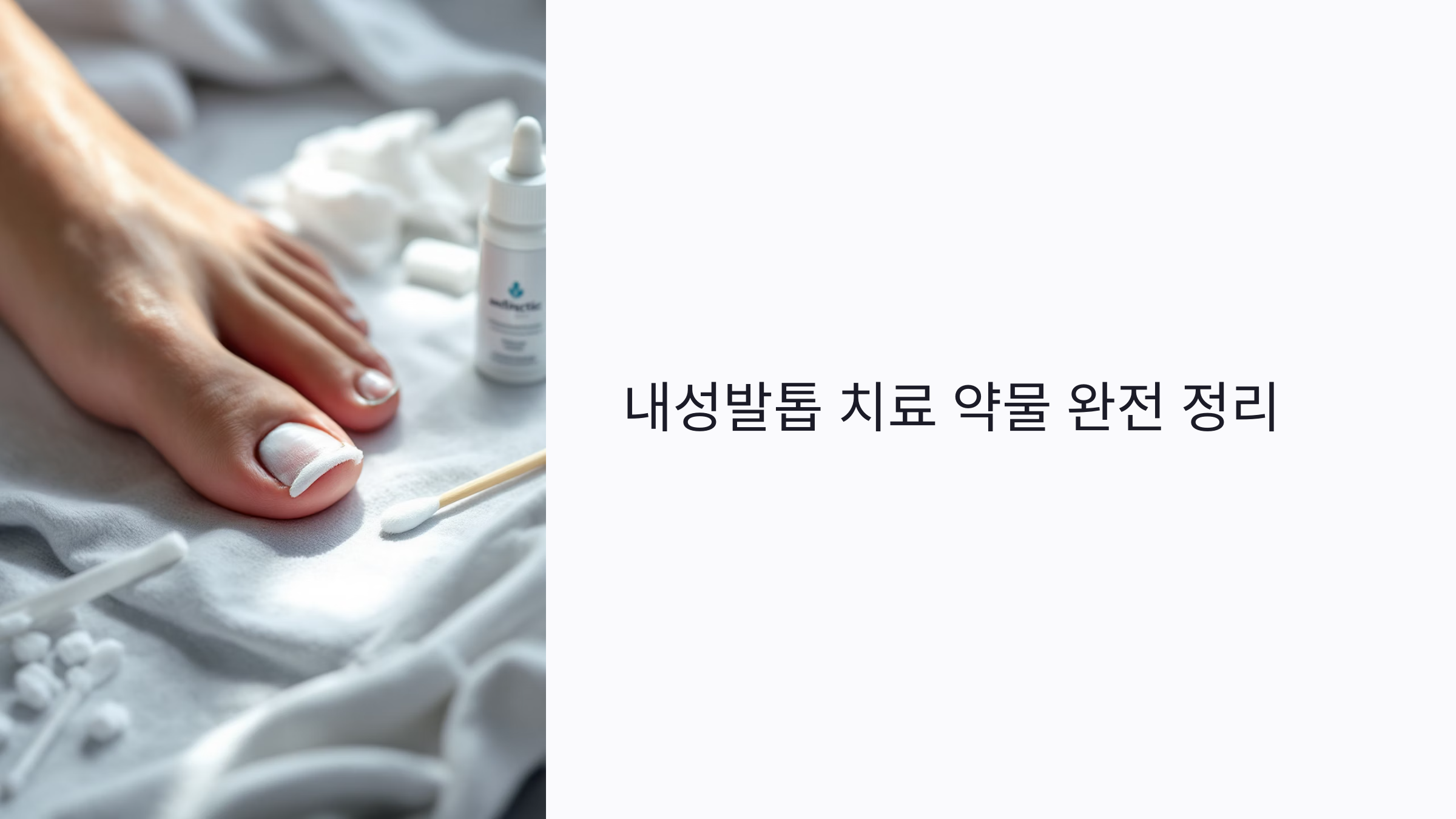 내성발톱엔 어떤 약이 효과 있나요? 치료 연고부터 처방약까지 완전 정리!