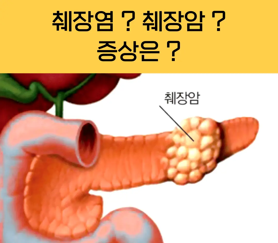 췌장효소추천